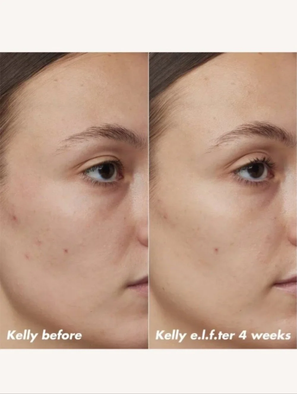 🎉2•$13/3•$18🎉 E.L.F. SKIN Plz Clarify Facial Oil